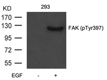 FAK(Phospho-Tyr397)
