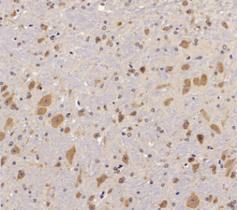 Rabbit Polyclonal Antibody to FAK(Phospho-Tyr397)