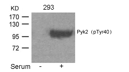 Pyk2(Phospho-Tyr402)