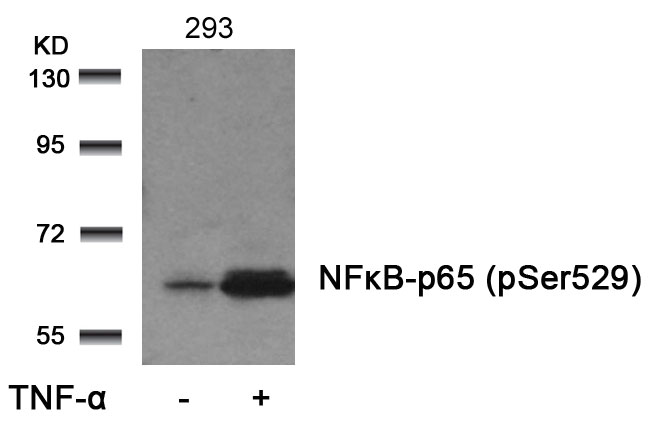 NFkB-p65(Phospho-Ser529)