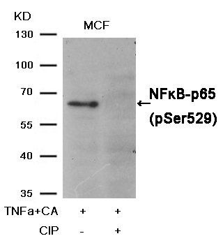 Rabbit Polyclonal Antibody to NFkB-p65(Phospho-Ser529)