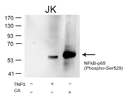 Rabbit Polyclonal Antibody to NFkB-p65(Phospho-Ser529)