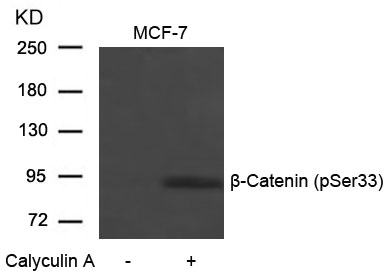 b-Catenin(Phospho-Ser33)