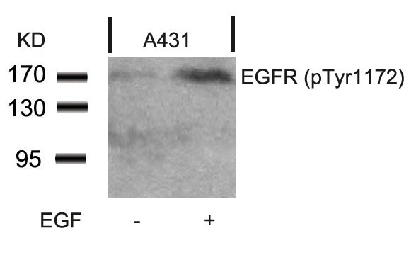 EGFR(Phospho-Tyr1172)