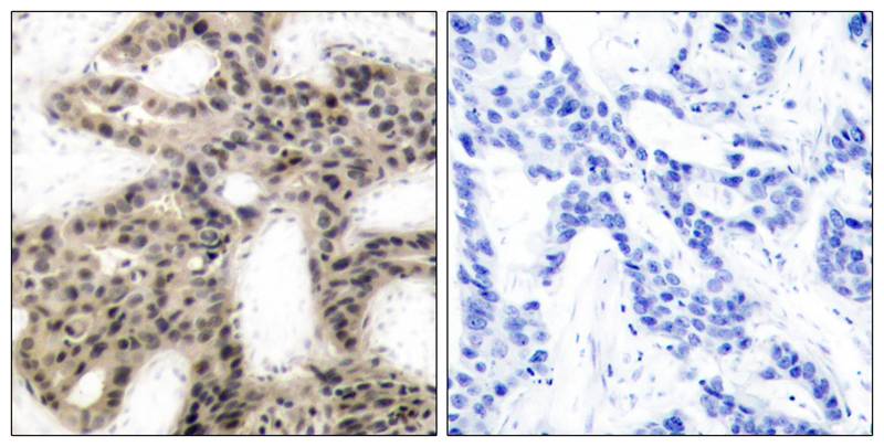 Rabbit Polyclonal Antibody to 4E-BP1(Phospho-Thr46)