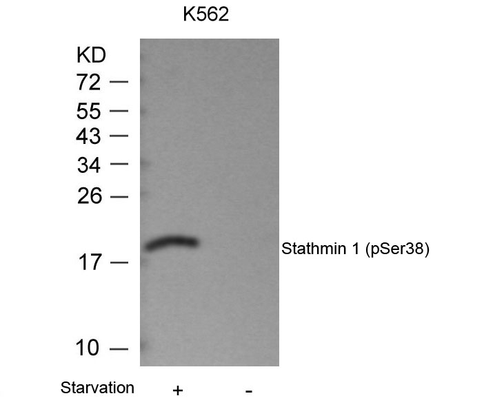 Stathmin1(Phospho-Ser38)