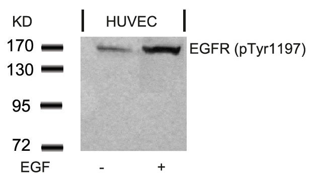 EGFR(Phospho-Tyr1197)