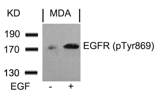EGFR(Phospho-Tyr869)
