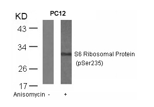 S6 Ribosomal Protein(Phospho-Ser235)