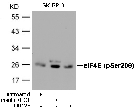 eIF4E(Phospho-Ser209)