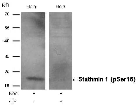 Rabbit Polyclonal Antibody to Stathmin1(Phospho-Ser16)