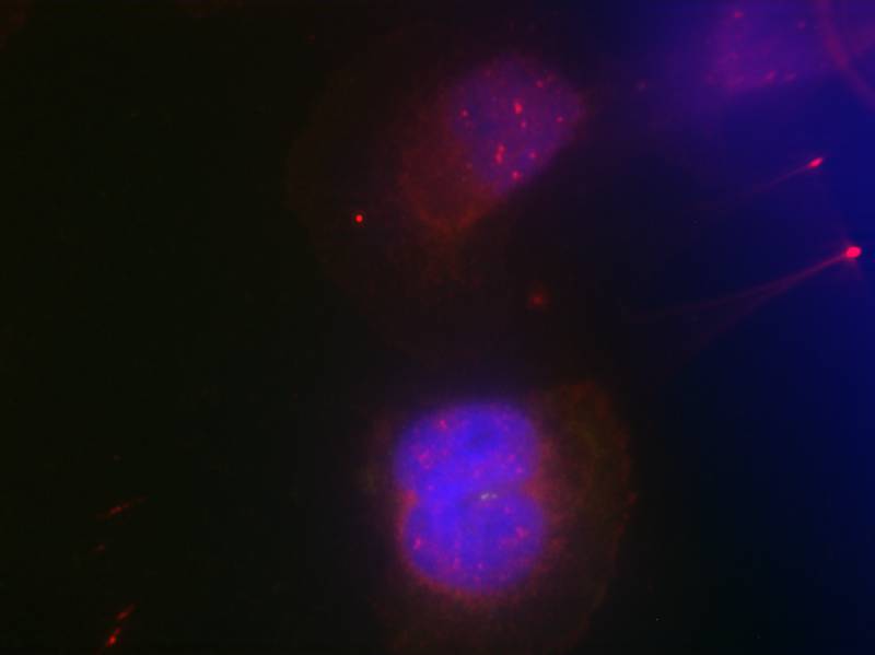 BRCA1(Phospho-Ser988)