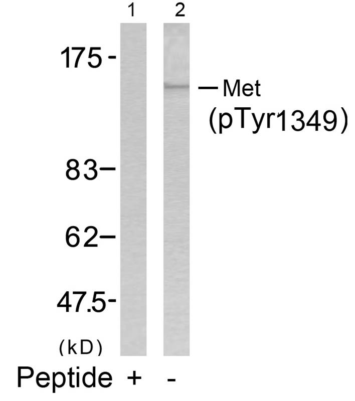 Met(Phospho-Tyr1349)