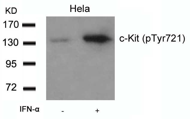 c-Kit(Phospho-Tyr721)