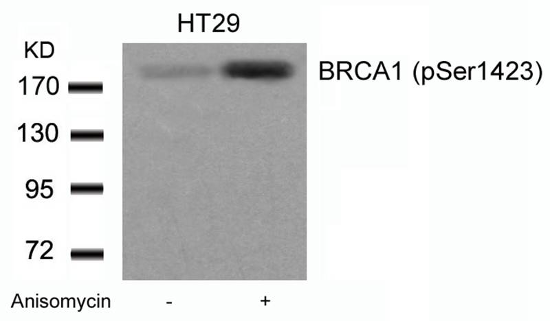 BRCA1(Phospho-Ser1423)