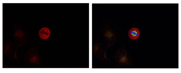 Rabbit Polyclonal Antibody to p44/42 MAP Kinase(Phospho-Tyr204)