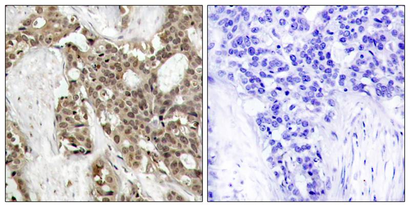 Rabbit Polyclonal Antibody to p44/42 MAP Kinase(Phospho-Tyr204)