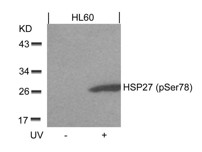 HSP27(Phospho-Ser78)