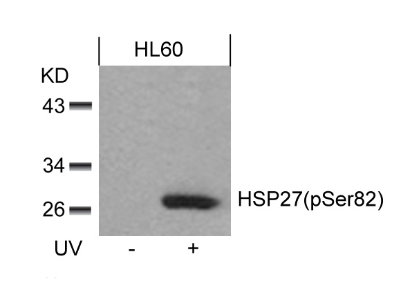 HSP27(Phospho-Ser82)