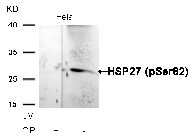 Rabbit Polyclonal Antibody to HSP27(Phospho-Ser82)