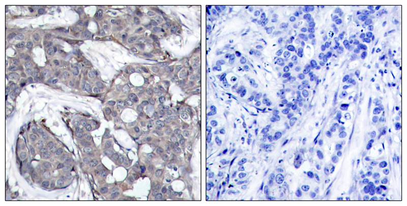 Rabbit Polyclonal Antibody to HSP27(Phospho-Ser82)