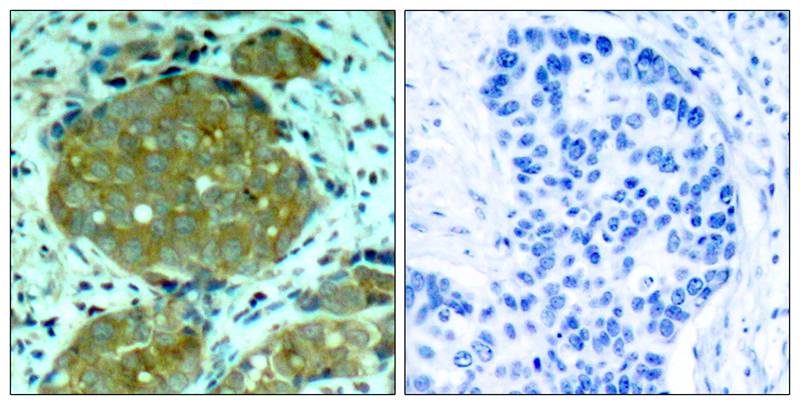 Rabbit Polyclonal Antibody to NFkB-p105(Phospho-Ser932)