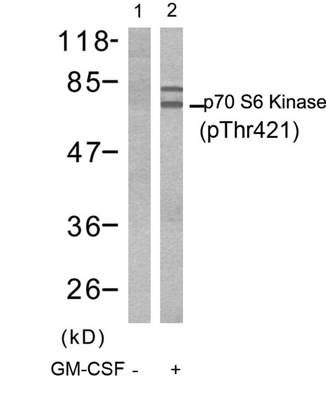 p7S6 Kinase(Phospho-Thr421)