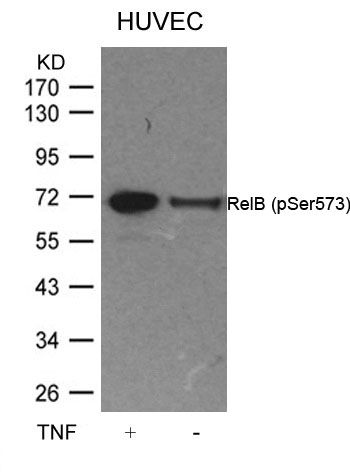 RelB(Phospho-Ser573)