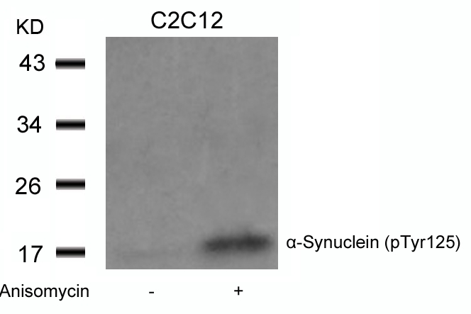 a-Synuclein(Phospho-Tyr125)