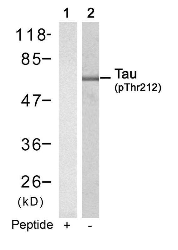 Tau(Phospho-Thr212)