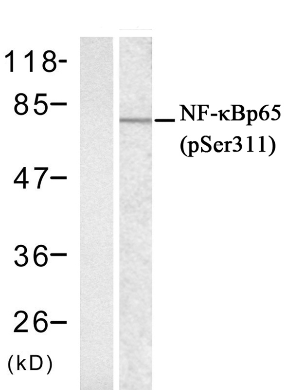 NFkB-p65 (phospho-Ser311)
