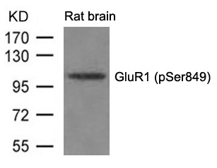 GluR1(phospho-Ser849)