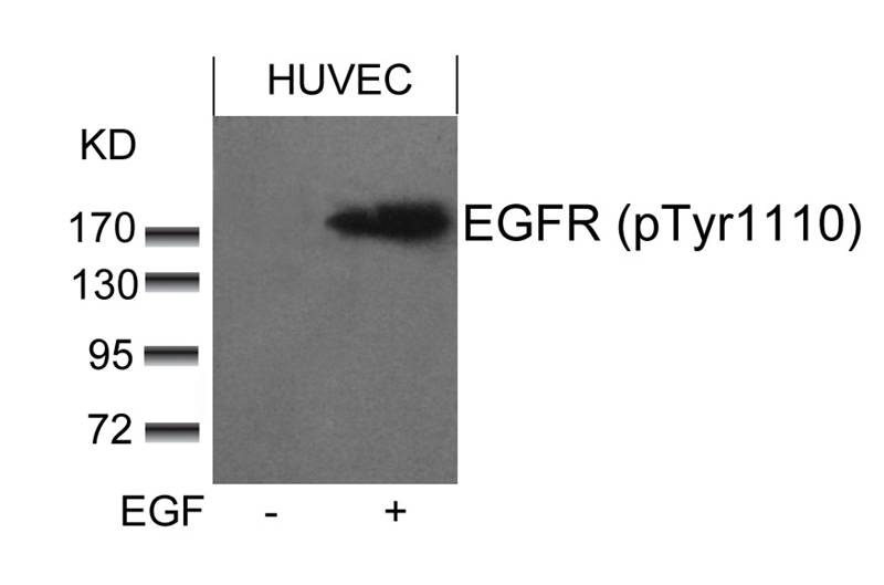 EGFR(phospho-Tyr1110)