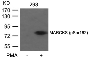MARCKS(Phospho-Ser162)