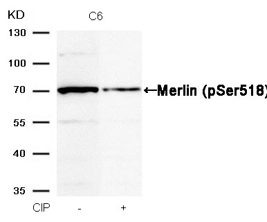 Rabbit Polyclonal Antibody to Merlin(Phospho-Ser518)