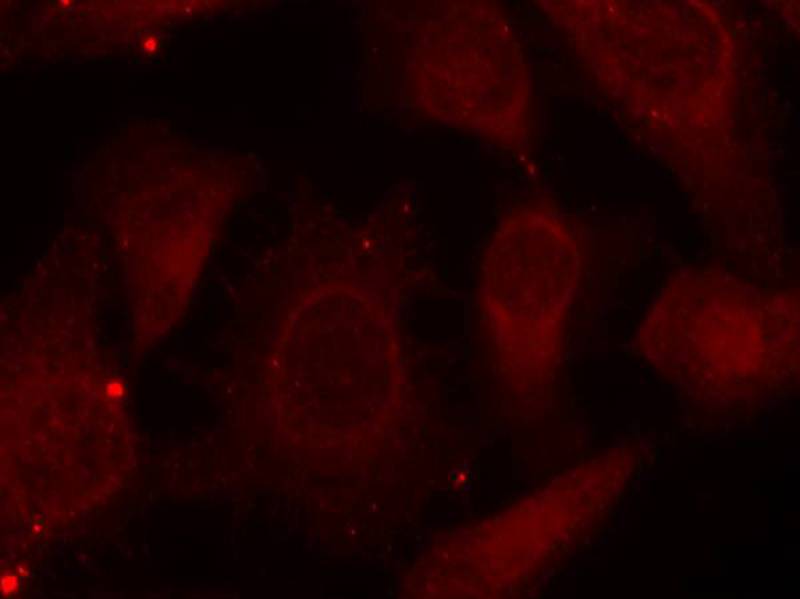 Rabbit Polyclonal Antibody to Merlin(Phospho-Ser518)