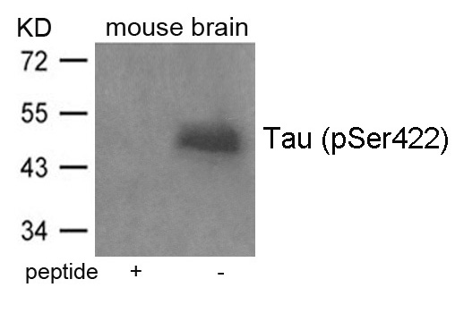 Tau(Phospho-Ser422)