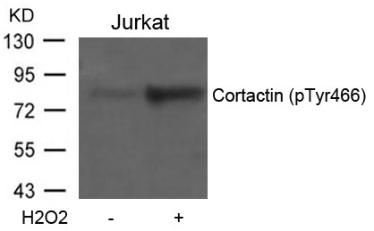Cortactin(Phospho-Tyr466)