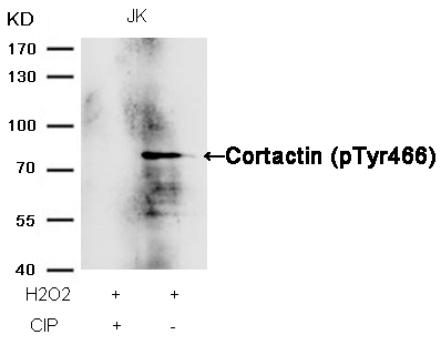 Rabbit Polyclonal Antibody to Cortactin(Phospho-Tyr466)