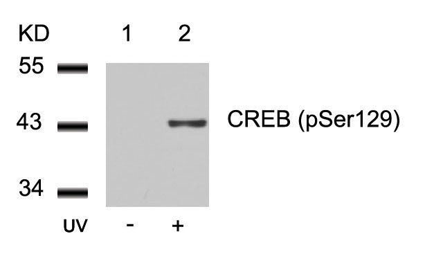 CREB(Phospho-Ser129)