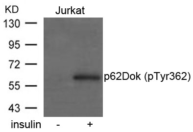 p62Dok(phospho-Tyr362)