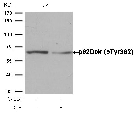 Rabbit Polyclonal Antibody to p62Dok(phospho-Tyr362)
