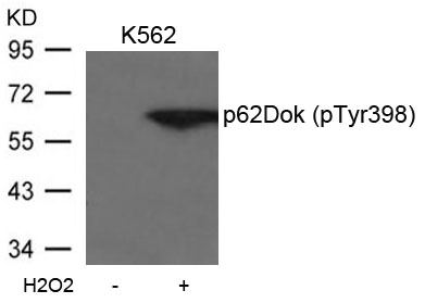 p62Dok(phospho-Tyr398)