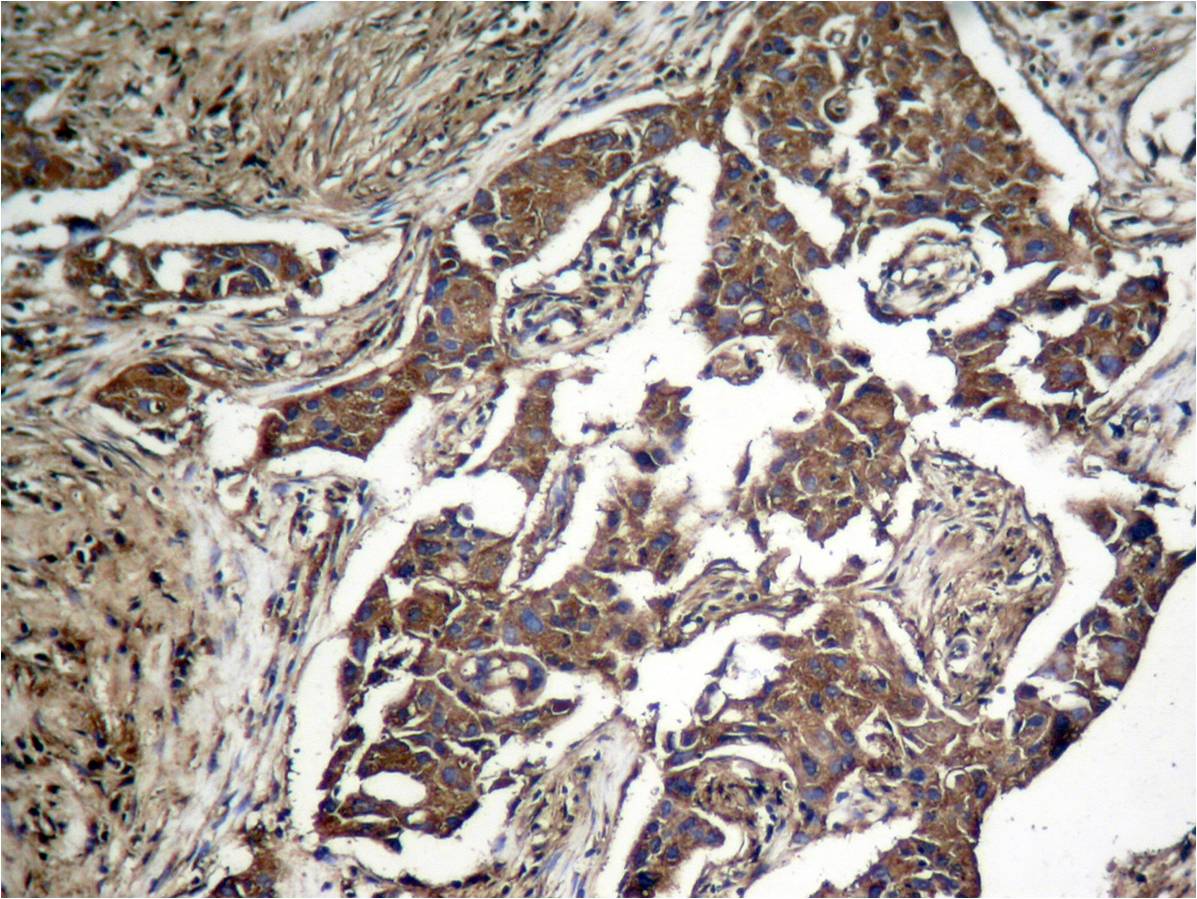 Rabbit Polyclonal Antibody to eIF2a(Phospho-Ser51)