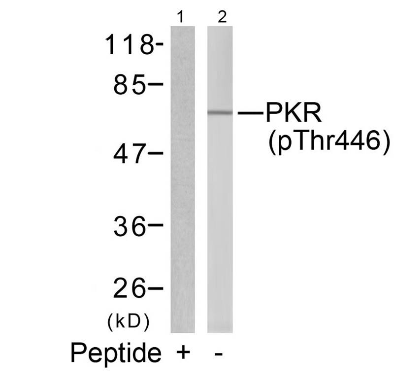 PKR(Phospho-Thr446)