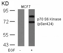 p7S6 Kinase(Phospho-Ser424)