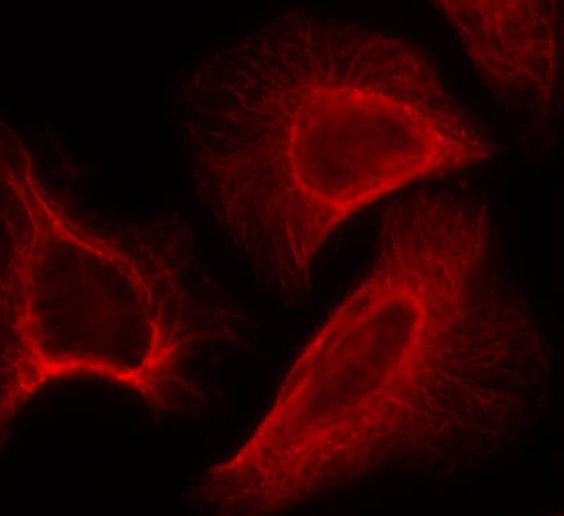 Rabbit Polyclonal Antibody to p7S6 Kinase(Phospho-Ser424)