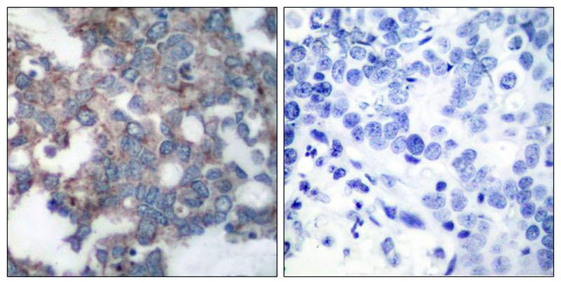 Rabbit Polyclonal Antibody to p7S6 Kinase(Phospho-Ser424)
