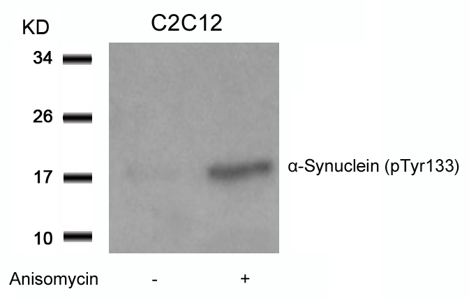 a-Synuclein(Phospho-Tyr133)