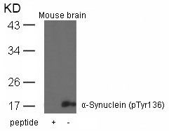 a-Synuclein(Phospho-Tyr136)